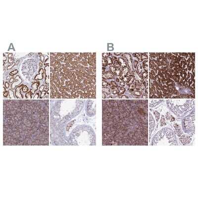 Immunohistochemistry-Paraffin: GCDH Antibody [NBP2-48549]