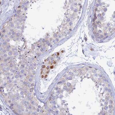 Immunohistochemistry-Paraffin: GCDH Antibody [NBP2-48549]