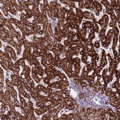 Immunohistochemistry-Paraffin: GCDH Antibody [NBP2-48907]