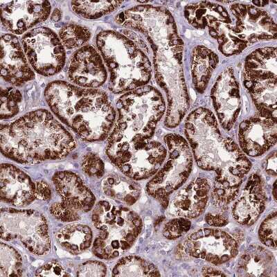 Immunohistochemistry-Paraffin: GCDH Antibody [NBP2-48907]