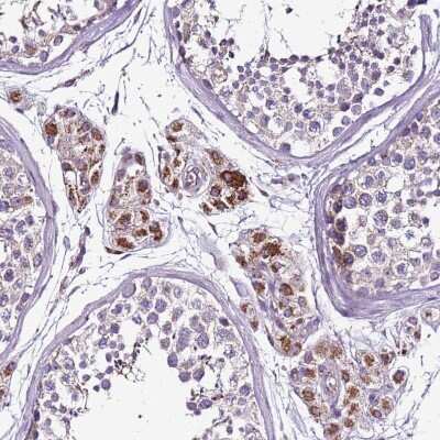 Immunohistochemistry-Paraffin: GCDH Antibody [NBP2-48907]