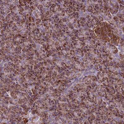 Immunohistochemistry-Paraffin: GCDH Antibody [NBP2-48907]