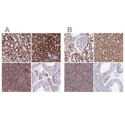 Immunohistochemistry-Paraffin: GCDH Antibody [NBP2-48907]