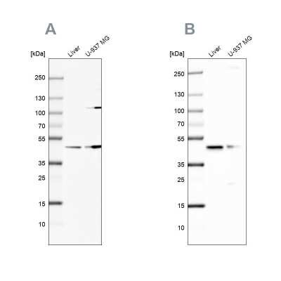 Western Blot: GCDH Antibody [NBP2-48549]