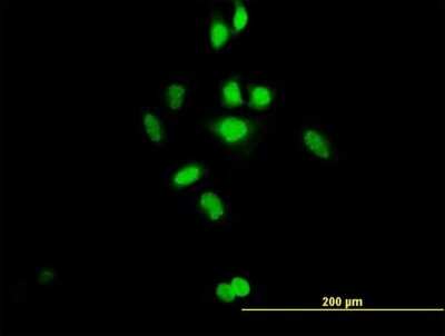 Immunocytochemistry/ Immunofluorescence: GCFC1 Antibody [H00094104-B01P]
