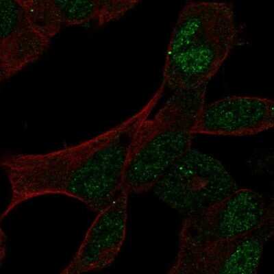 Immunocytochemistry/ Immunofluorescence: GCFC2 Antibody [NBP2-58823]