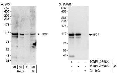 Western Blot: GCFC2 Antibody [NBP1-05984]