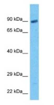 Western Blot: GCFC2 Antibody [NBP3-09368]