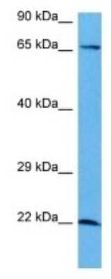 Western Blot: GCFC2 Antibody [NBP3-09963]