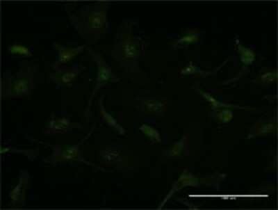 Immunocytochemistry/ Immunofluorescence: GCHFR Antibody (4G6) [H00002644-M01]