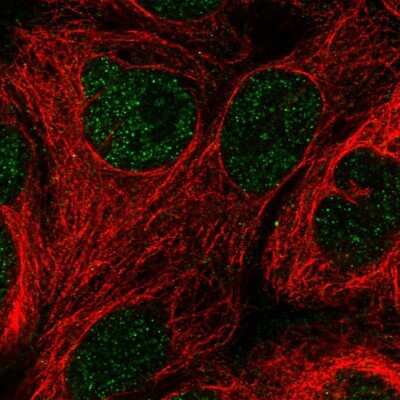 Immunocytochemistry/ Immunofluorescence: GCHFR Antibody [NBP1-91931]