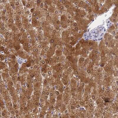 Immunohistochemistry-Paraffin: GCHFR Antibody [NBP1-91931]