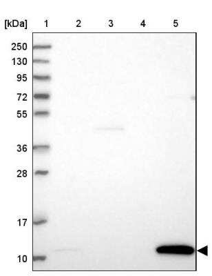 Western Blot: GCHFR Antibody [NBP1-91931]