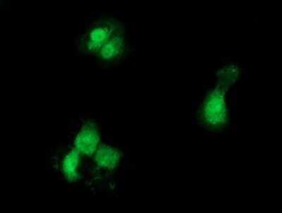 Immunocytochemistry/ Immunofluorescence: GCKR Antibody (OTI1E7) - Azide and BSA Free [NBP2-70823]