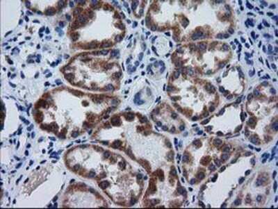 Immunohistochemistry: GCKR Antibody (OTI1E7) - Azide and BSA Free [NBP2-70823]