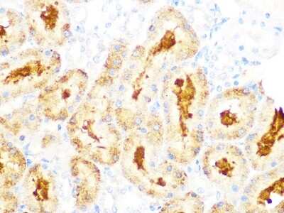 Immunohistochemistry-Paraffin: GCLC Antibody (0X1H3) [NBP3-16422]