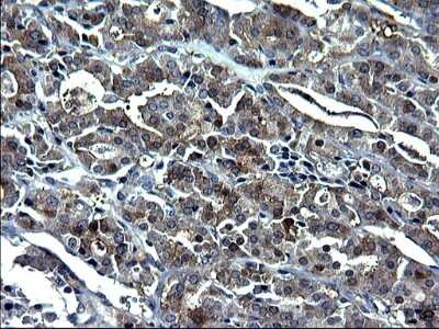 Immunohistochemistry: GCLC Antibody (OTI1A3) [NBP2-45830]