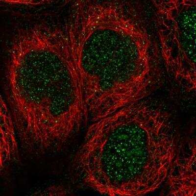 Immunocytochemistry/ Immunofluorescence: GCLC Antibody [NBP1-81840]