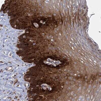 Immunohistochemistry-Paraffin: GCLC Antibody [NBP1-83375]