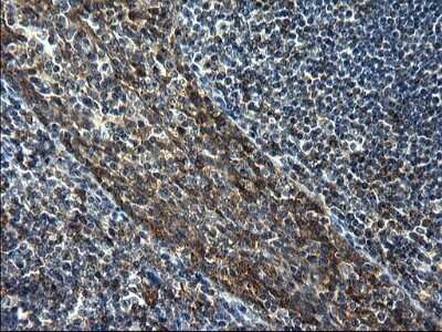 Immunohistochemistry: GCLC Antibody (OTI1A3) - Azide and BSA Free [NBP2-70830]