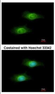 Immunocytochemistry/ Immunofluorescence: GCLM Antibody [NBP2-16624]