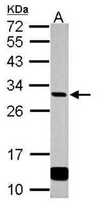 Western Blot: GCLM Antibody [NBP2-16624]