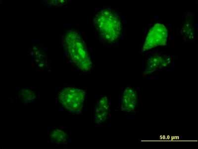 Immunocytochemistry/ Immunofluorescence: GCM1 Antibody (2E11) [H00008521-M05]