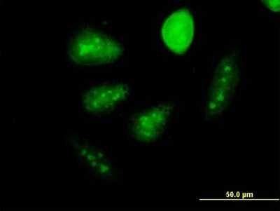 Immunocytochemistry/ Immunofluorescence: GCM1 Antibody (3D3) [H00008521-M06]