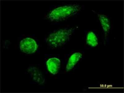 Immunocytochemistry/ Immunofluorescence: GCM1 Antibody (4E8) [H00008521-M04]