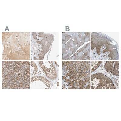 Immunohistochemistry-Paraffin: GCN1L1 Antibody [NBP1-83381]