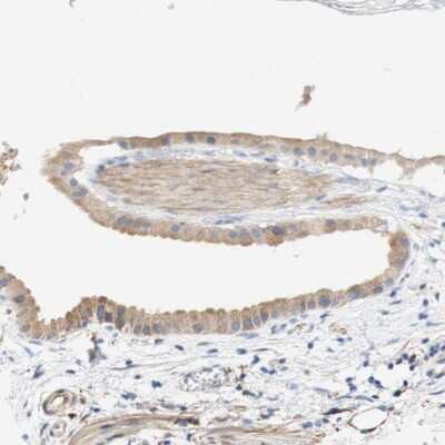 Immunohistochemistry-Paraffin: GCN2 Antibody [NBP2-38126]