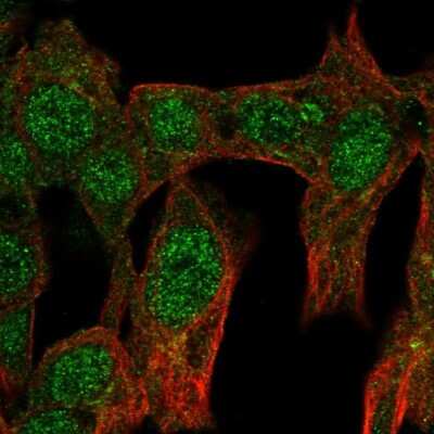Immunocytochemistry/ Immunofluorescence: GCNF/NR6A1 Antibody [NBP2-54922]