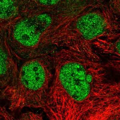 Immunocytochemistry/ Immunofluorescence: GCNF/NR6A1 Antibody [NBP2-55277]