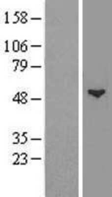 Western Blot: Glucosaminyl (N-acetyl) Transferase 1/GCNT1 Overexpression Lysate [NBP2-08271]