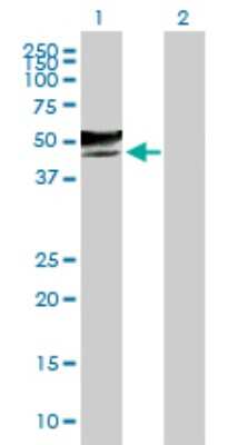 Western Blot: GCNT2 Antibody [H00002651-B01P]