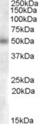 Western Blot: GCNT3 Antibody [NB100-93400]