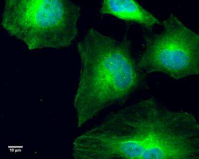 Immunocytochemistry/ Immunofluorescence: GCP4 Antibody (812) [NBP2-43586]