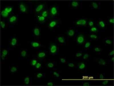 Immunocytochemistry/ Immunofluorescence: GCR2 Antibody (1A11) [H00011319-M01]