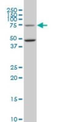 Western Blot: GCR2 Antibody (1E5) [H00011319-M02]