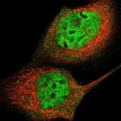 Immunocytochemistry/ Immunofluorescence: GCR2 Antibody [NBP2-33278]