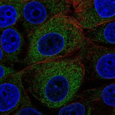 Immunocytochemistry/ Immunofluorescence: GCS1 Antibody [NBP2-58996]