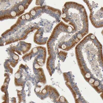 Immunohistochemistry-Paraffin: GCS1 Antibody [NBP1-81839]