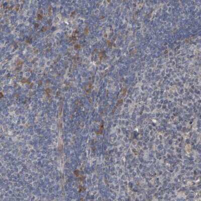 Immunohistochemistry-Paraffin: GCS1 Antibody [NBP1-81839]