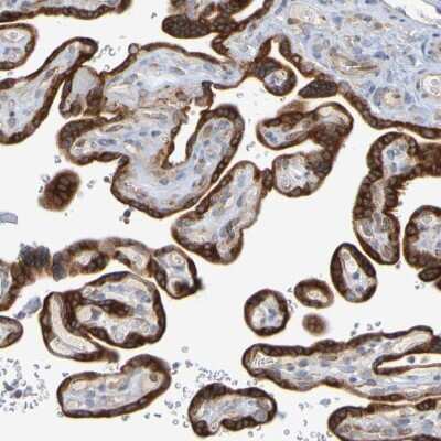 Immunohistochemistry-Paraffin: GCS1 Antibody [NBP1-81839]
