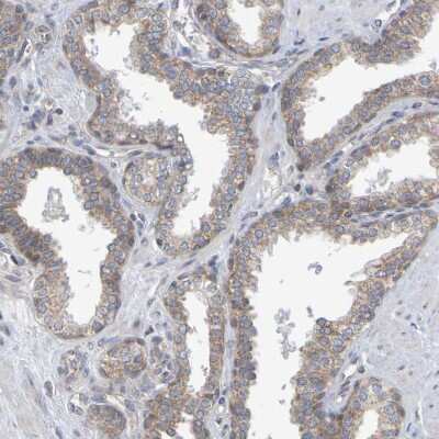 Immunohistochemistry-Paraffin: GCS1 Antibody [NBP1-81839]