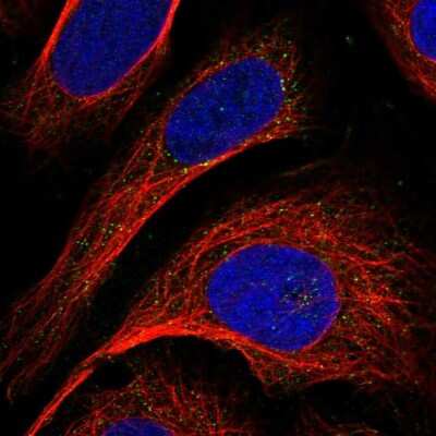 Immunocytochemistry/ Immunofluorescence: GCSH Antibody [NBP1-85842]