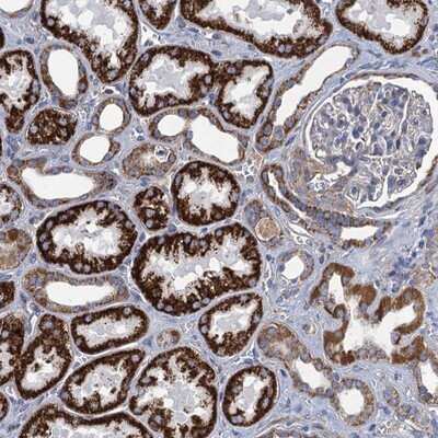 Immunohistochemistry-Paraffin: GCSH Antibody [NBP1-85842]