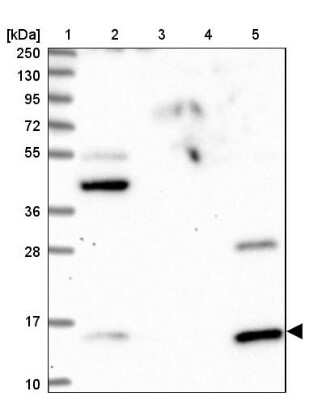 Western Blot: GCSH Antibody [NBP1-85842]