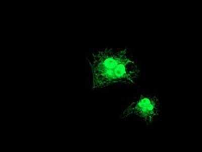Immunocytochemistry/ Immunofluorescence: GDAP1L1 Antibody (OTI1G5) - Azide and BSA Free [NBP2-72182]