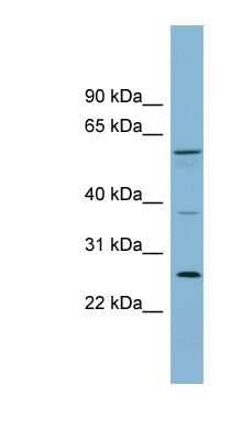 Western Blot: GDAP2 Antibody [NBP1-56959]